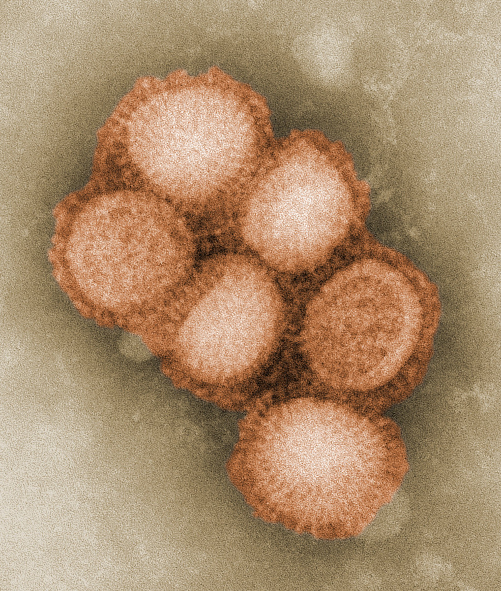 Так выглядит многократно увеличенный под микроскопом вирус гриппа А (H1N1)